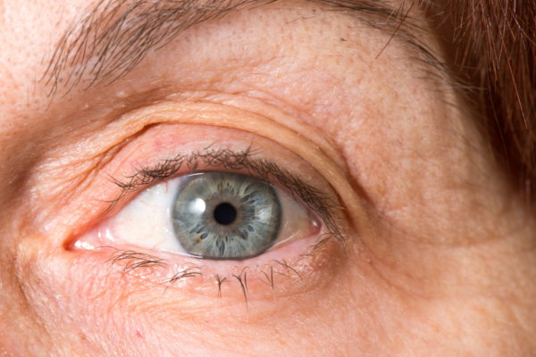 Eyes on the Future: LASIK and the Prevention of Age-Related Vision Issues featured image